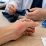 Inflammation du pouce : tendinite de De Quervain au poignet, attelle et froid